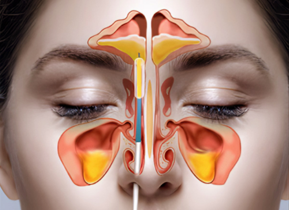 Otorrino en Mérida, Patología de la nariz y senos parnasales